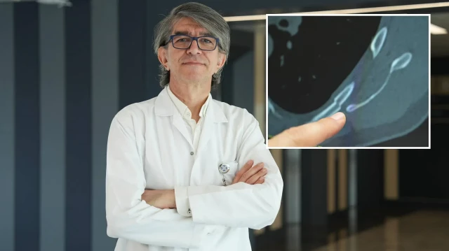 uzman isim uyardi oksururken kaburgalariniz kirilabilir xGk842l8